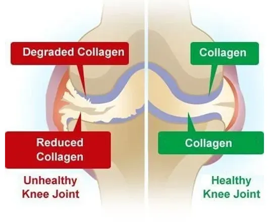 Collagen